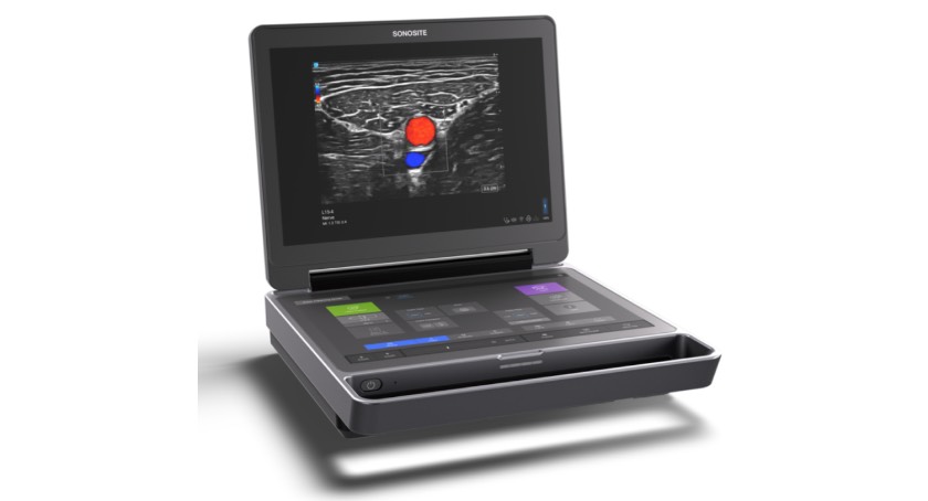 Fujifilm Sonosite Launches Sonosite MT Ultrasound System